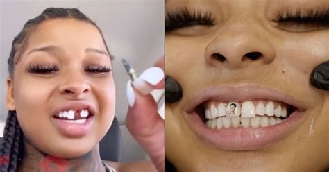 what happened to chrisean rock front tooth|Chrisean Rock Reveals She Is Replacing Her Tooth。